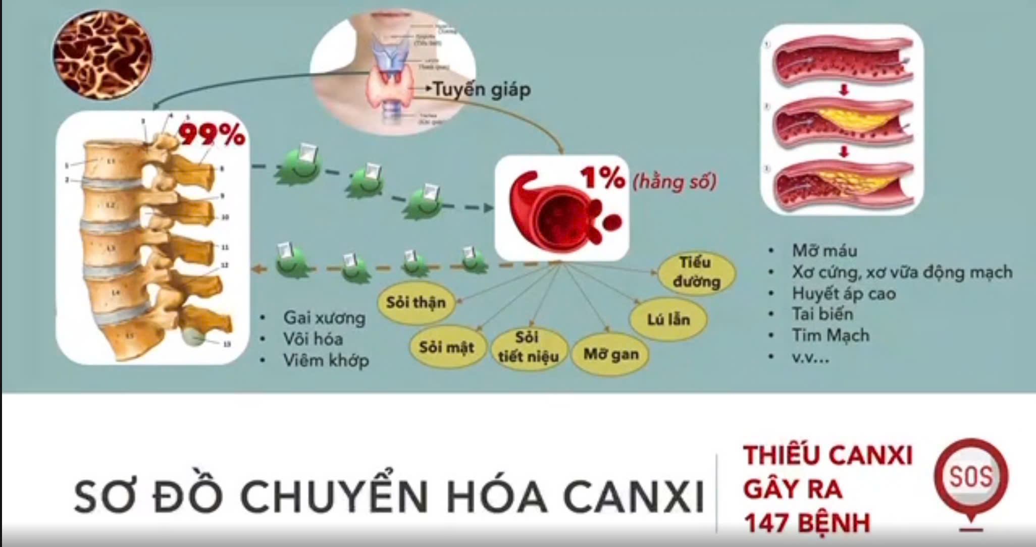 Sơ đồ chuyển hoá CANXI - Thiếu CANXI gây ra 147 bệnh 